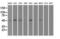 Alpha-1-antitrypsin antibody, GTX83665, GeneTex, Western Blot image 
