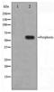 Peripherin antibody, LS-C415938, Lifespan Biosciences, Western Blot image 