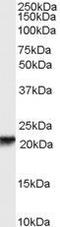 Retinol Binding Protein 4 antibody, GTX89178, GeneTex, Western Blot image 