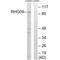 Rho GTPase Activating Protein 9 antibody, A11899, Boster Biological Technology, Western Blot image 