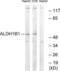 Aldehyde Dehydrogenase 1 Family Member B1 antibody, LS-C119707, Lifespan Biosciences, Western Blot image 
