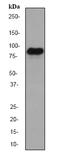 Minichromosome Maintenance Complex Component 7 antibody, ab52489, Abcam, Western Blot image 