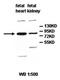 Zinc Finger Protein 28 antibody, orb77874, Biorbyt, Western Blot image 