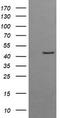 Gamma-Butyrobetaine Hydroxylase 1 antibody, LS-C174488, Lifespan Biosciences, Western Blot image 