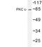 Protein Kinase C Epsilon antibody, LS-C176664, Lifespan Biosciences, Western Blot image 