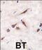 ES Cell Expressed Ras antibody, PA5-71907, Invitrogen Antibodies, Immunohistochemistry paraffin image 