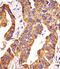 Matrix Metallopeptidase 14 antibody, 62-171, ProSci, Immunohistochemistry frozen image 