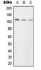 Serine/threonine-protein kinase D1 antibody, LS-C354061, Lifespan Biosciences, Western Blot image 