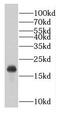 Gem Nuclear Organelle Associated Protein 6 antibody, FNab03421, FineTest, Western Blot image 
