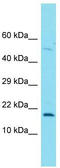 FOXL2 Neighbor antibody, TA334911, Origene, Western Blot image 