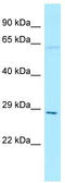 Thiamine Triphosphatase antibody, TA343262, Origene, Western Blot image 