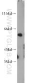 Paired Box 3 antibody, 21386-1-AP, Proteintech Group, Western Blot image 
