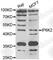 Inositol Hexakisphosphate Kinase 2 antibody, A7192, ABclonal Technology, Western Blot image 