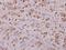 Cofilin 1 antibody, A01525S3, Boster Biological Technology, Immunohistochemistry frozen image 
