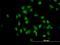 TUB Like Protein 2 antibody, H00007288-M03, Novus Biologicals, Immunofluorescence image 