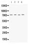 Potassium Voltage-Gated Channel Subfamily A Member 4 antibody, PB9807, Boster Biological Technology, Western Blot image 