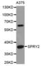 Sprouty RTK Signaling Antagonist 2 antibody, LS-C334596, Lifespan Biosciences, Western Blot image 