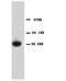 Annexin A1 antibody, LS-C171648, Lifespan Biosciences, Western Blot image 