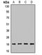 Peptidylprolyl Isomerase H antibody, LS-C668137, Lifespan Biosciences, Western Blot image 