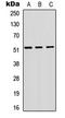 Vasoactive Intestinal Peptide Receptor 1 antibody, LS-C358387, Lifespan Biosciences, Western Blot image 
