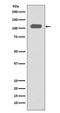 Integrin Subunit Beta 3 antibody, M00587-1, Boster Biological Technology, Western Blot image 
