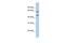 Adenosine Deaminase 2 antibody, PA5-43014, Invitrogen Antibodies, Western Blot image 