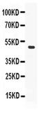 Perilipin 2 antibody, PA5-79830, Invitrogen Antibodies, Western Blot image 