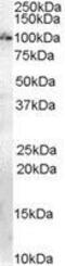 Anillin Actin Binding Protein antibody, GTX89306, GeneTex, Western Blot image 