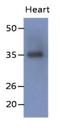 Sarcoglycan Delta antibody, NBP2-42662, Novus Biologicals, Western Blot image 