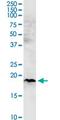 Coiled-Coil-Helix-Coiled-Coil-Helix Domain Containing 4 antibody, MA5-24519, Invitrogen Antibodies, Western Blot image 