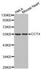 Chaperonin Containing TCP1 Subunit 4 antibody, abx126854, Abbexa, Western Blot image 