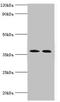 Carbonic Anhydrase 14 antibody, LS-C675442, Lifespan Biosciences, Western Blot image 