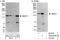 WD Repeat Domain 11 antibody, A302-632A, Bethyl Labs, Western Blot image 