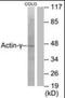 Actin Gamma 2, Smooth Muscle antibody, orb93583, Biorbyt, Western Blot image 