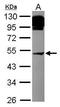 Adaptor Related Protein Complex 4 Subunit Mu 1 antibody, GTX115195, GeneTex, Western Blot image 