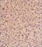 ATP Binding Cassette Subfamily A Member 1 antibody, NBP2-54792, Novus Biologicals, Immunohistochemistry paraffin image 