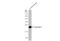 Lipocalin 2 antibody, GTX132906, GeneTex, Western Blot image 