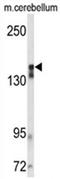 Kinase Insert Domain Receptor antibody, AP54510PU-N, Origene, Western Blot image 