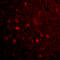 Mitochondrial Antiviral Signaling Protein antibody, A00169-2, Boster Biological Technology, Immunofluorescence image 