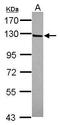 Intraflagellar Transport 122 antibody, GTX119175, GeneTex, Western Blot image 