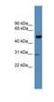 Galactose-3-O-Sulfotransferase 3 antibody, orb325553, Biorbyt, Western Blot image 