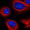 UTP3 Small Subunit Processome Component antibody, NBP2-58960, Novus Biologicals, Immunofluorescence image 