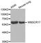 Polypeptide N-Acetylgalactosaminyltransferase 17 antibody, LS-B14501, Lifespan Biosciences, Western Blot image 