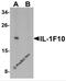 Interleukin 1 Family Member 10 antibody, 7503, ProSci, Western Blot image 