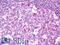 ETS Proto-Oncogene 2, Transcription Factor antibody, LS-B10720, Lifespan Biosciences, Immunohistochemistry paraffin image 