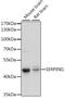 Serpin Family I Member 1 antibody, 16-189, ProSci, Western Blot image 