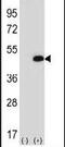 Eukaryotic Translation Initiation Factor 2B Subunit Gamma antibody, PA5-11759, Invitrogen Antibodies, Western Blot image 