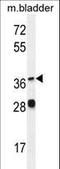 Fatty Acid Desaturase 1 antibody, LS-B9611, Lifespan Biosciences, Western Blot image 