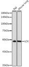 LCK Proto-Oncogene, Src Family Tyrosine Kinase antibody, GTX54287, GeneTex, Western Blot image 