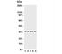 Caspase 6 antibody, R30512, NSJ Bioreagents, Western Blot image 